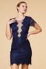  Winner Of The Lace Dress